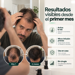 Nidusinject - tratamiento para el crecimiento del cabello